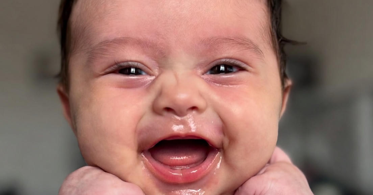 Don't Let the Wrong Bib Ruin Your Baby's Skin pic1